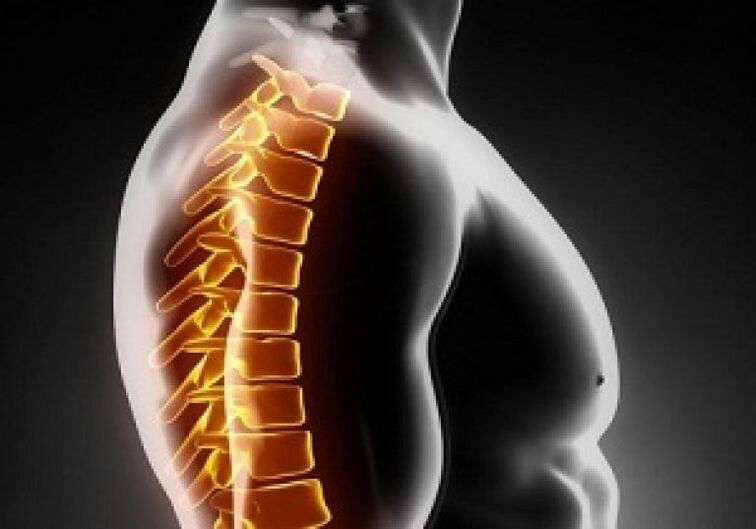 Torakalnu osteohondrozu prati bol i nelagoda u sredini leđa