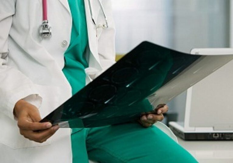 X-zraka će pomoći liječniku da dijagnosticira osteohondrozu torakalne kralježnice
